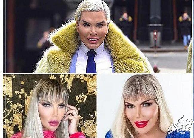 رکورد جراحی پلاستیک (3)